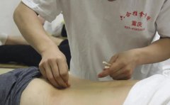 針灸初學(xué)者，你的持針手法正確嗎？
