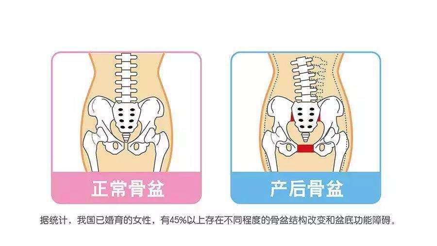 重慶主城產后康復哪家培訓機構比較好？