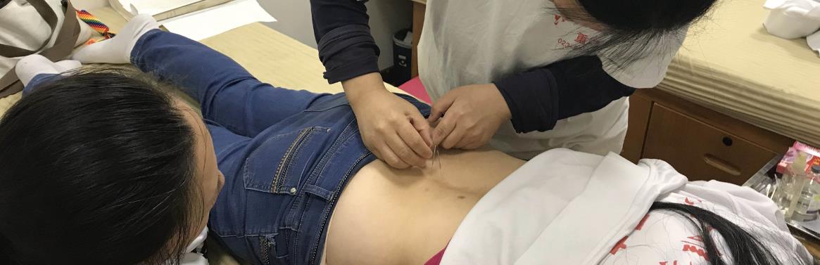 針灸作用強大，但不能隨便扎，這類人群不適合