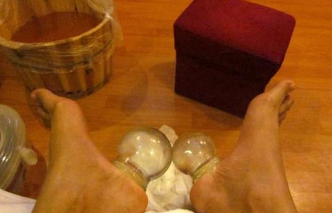 腳底也可以拔罐嗎？來看看六合學校怎么說
