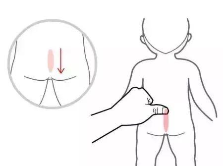 重慶小兒推拿培訓--小兒推拿臟腑辨證之脾胃辯證？