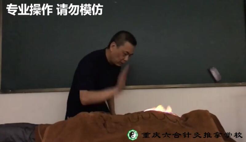 大家了解中醫火療嗎？其功效如何？
