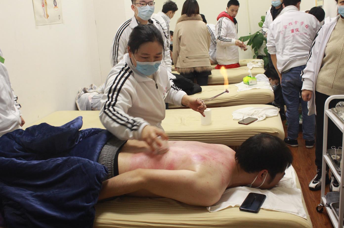 中醫拔罐不僅僅是排毒除濕效果好