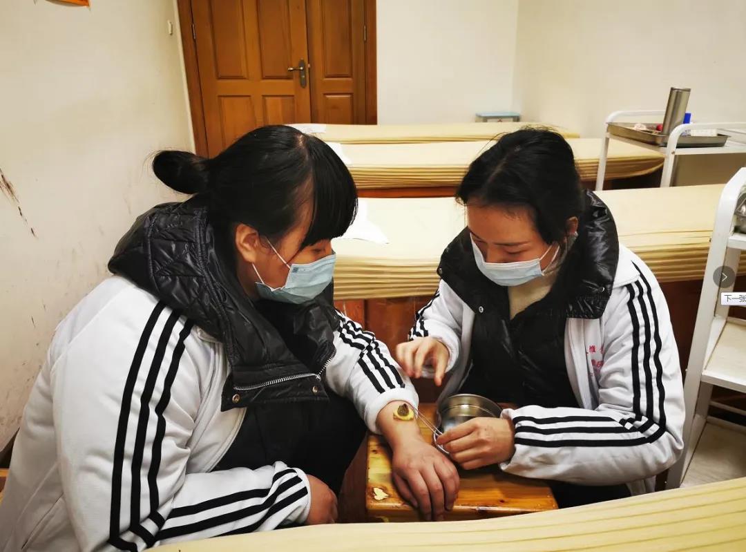 中醫適宜技術——隔姜艾灸