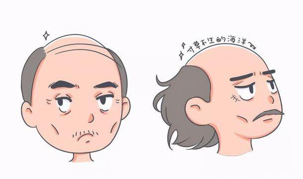 中年男人易脫發 中醫教你護發方法