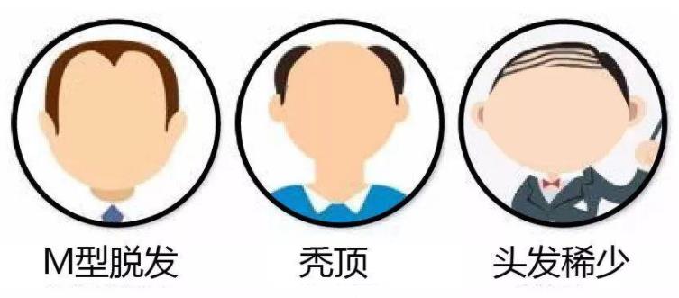 你有脫發困擾嗎？推拿按摩幫你治脫發