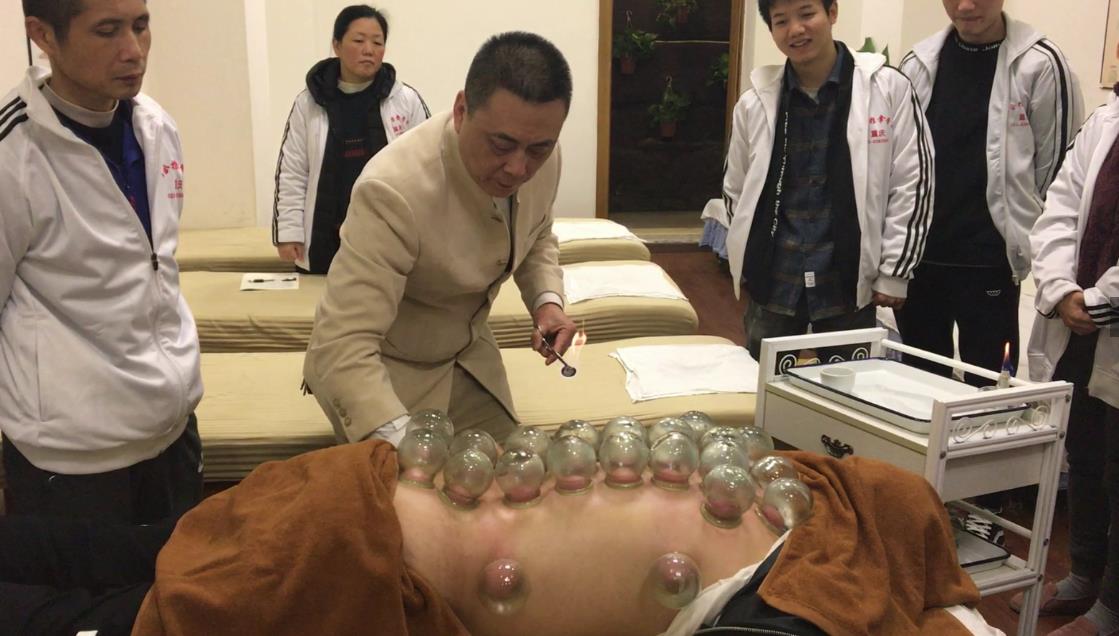 中醫拔罐治腰痛，來看看這三種腰痛的拔罐方法